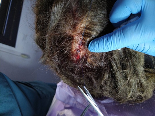 Klicka fr strre bild